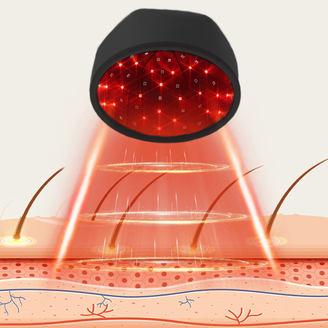 Nordic hair growth kasket